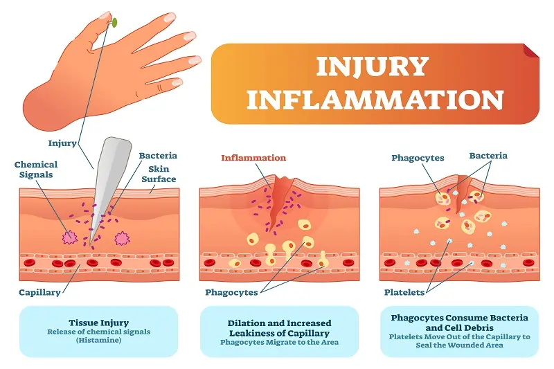 Wound Healing Proces Wound care LA, CA