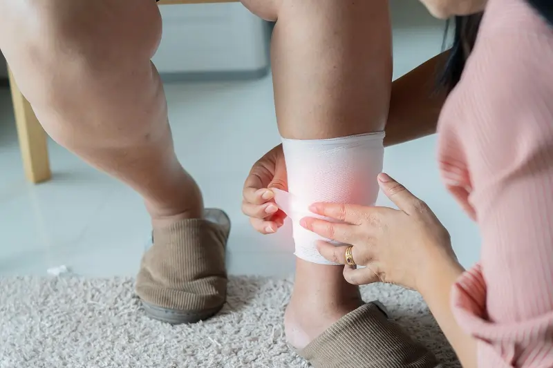 Dressings and Bandaging of Pressure Ulcers in LA