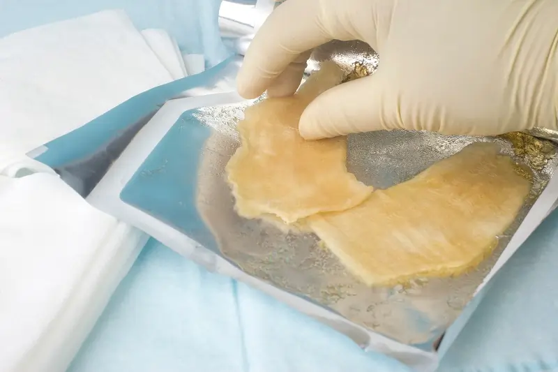 Wound Care and Dressing Choices in Los Angeles, CA